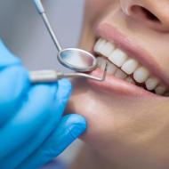Common Dental Procedures From a General Dentist in Setia Alam