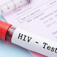 HIV - symptoms and treatment